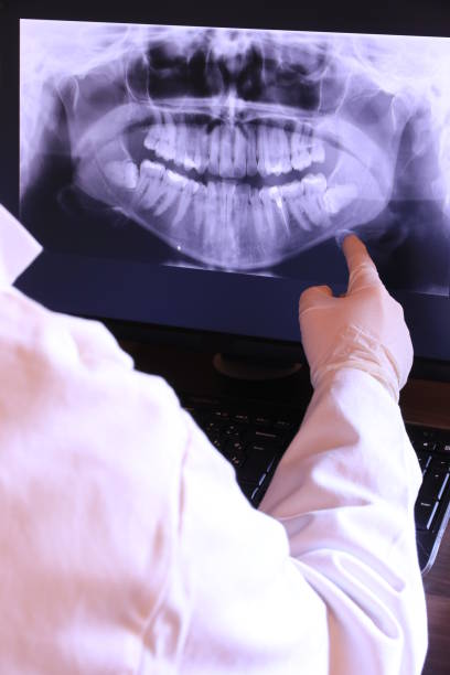 Best Emergency Treatment for Toothache in Abingdon, VA